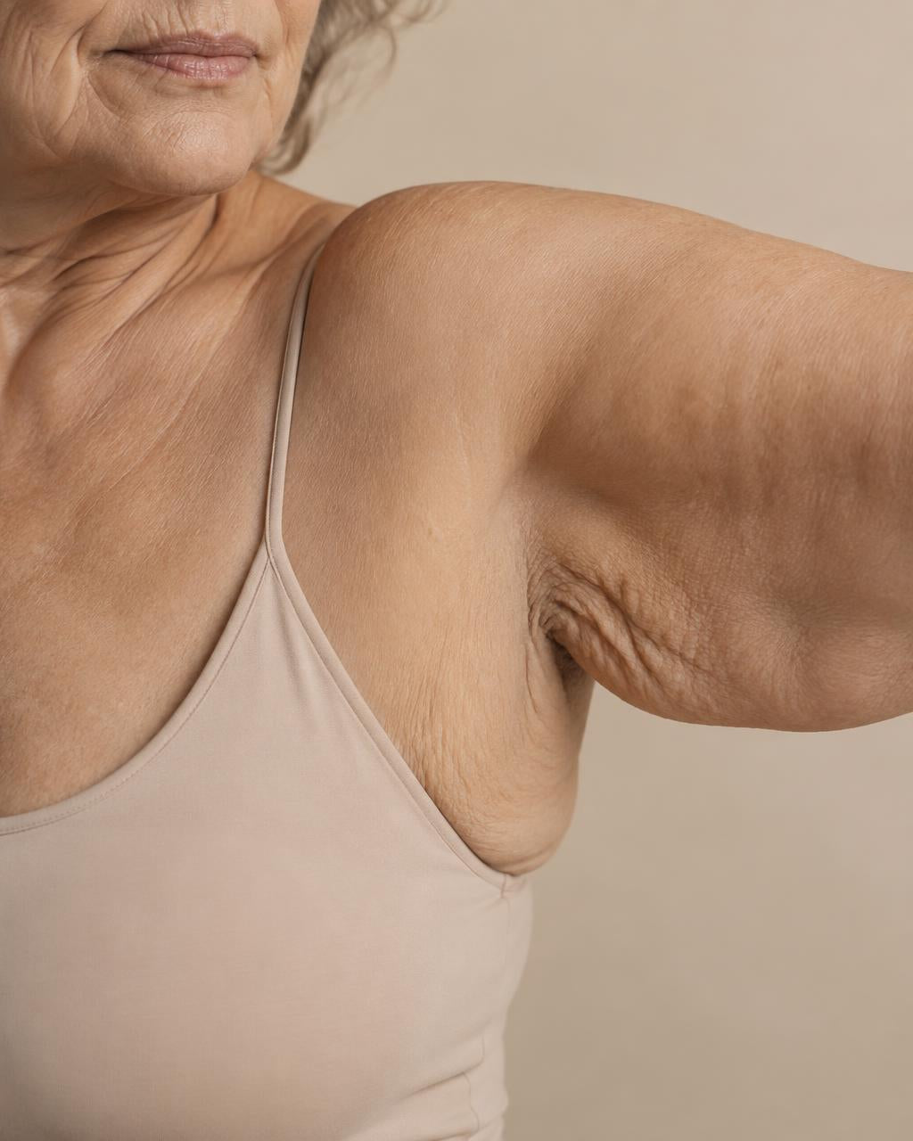 Bras d'une femme d'environ 70 ans, peau très relâchée
